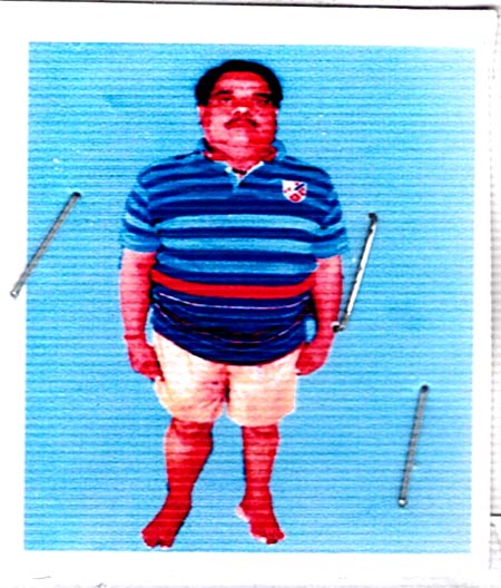 Koshi Viklang,Ngo in Bihar